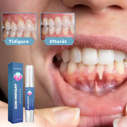 GumRelief™ | Lindrar tandkött & gerödning snabbt och effektivt