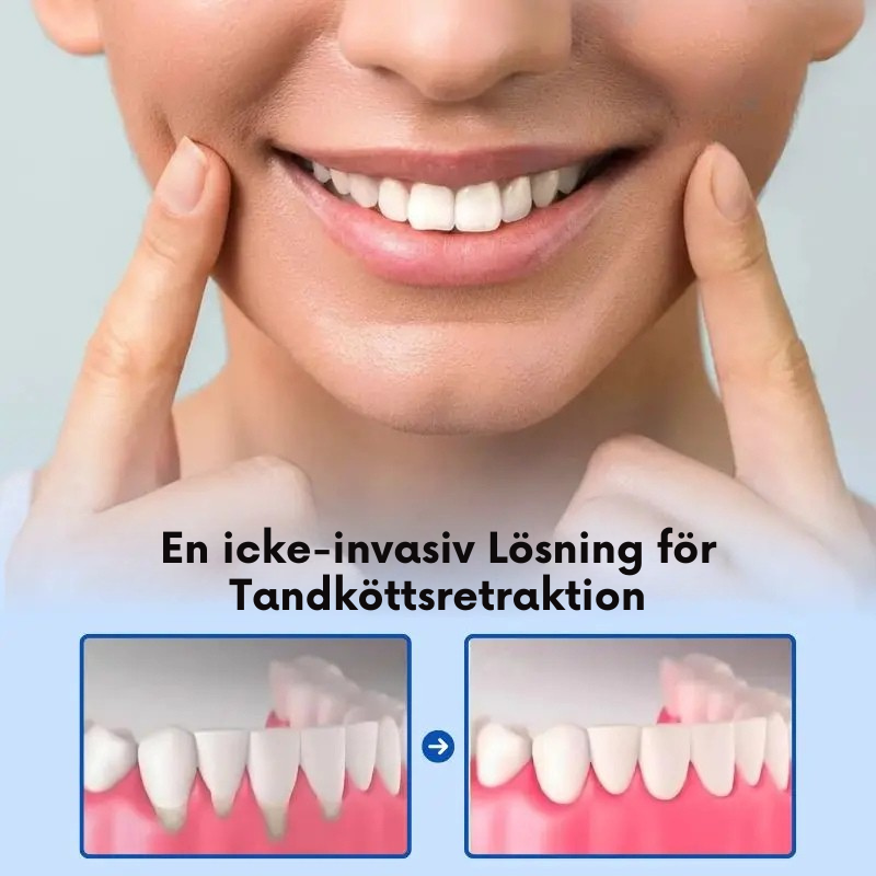 GumRelief™ | Lindrar tandkött & gerödning snabbt och effektivt