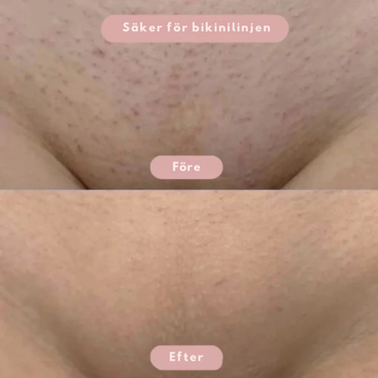 SmoothSkin™ | Intimbarbering uden irritation